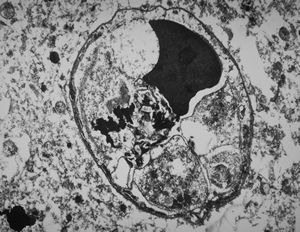 M, | cerebral cortex - malaric pigment